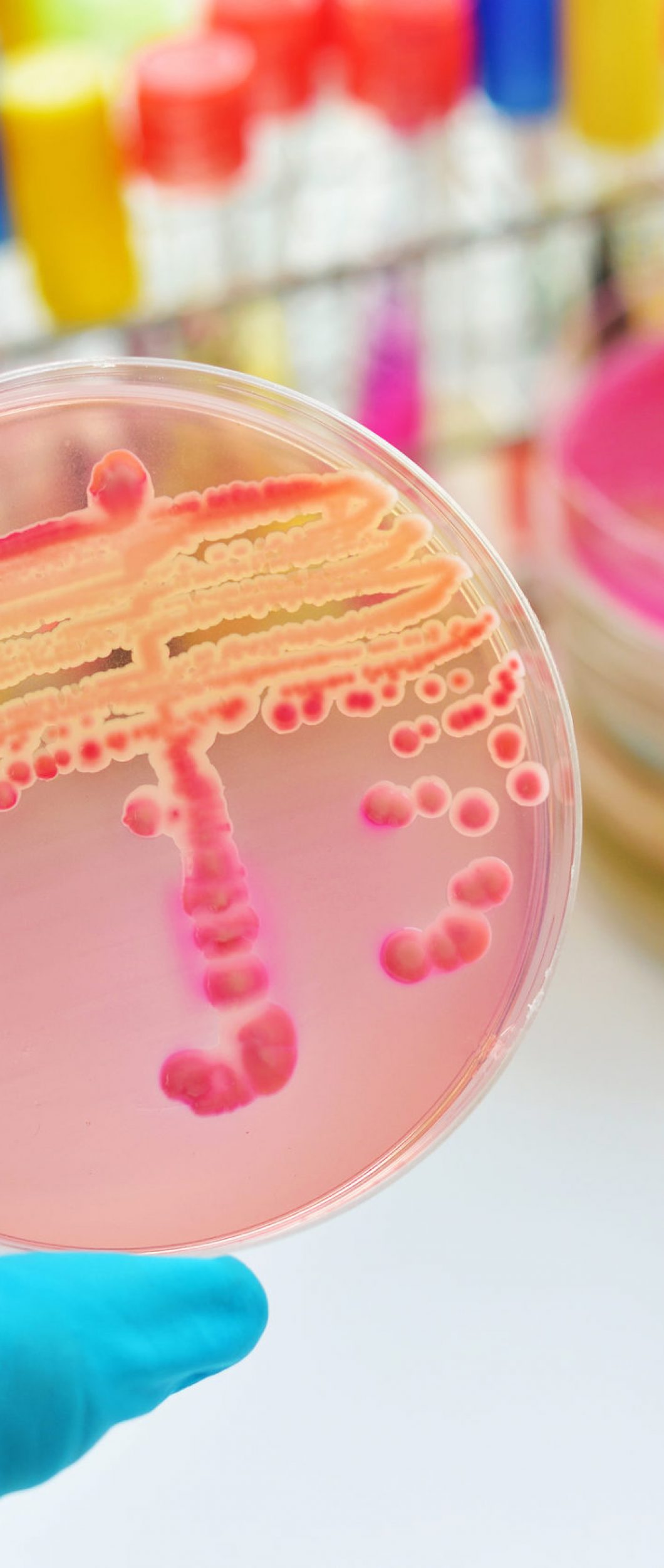 Food Poisoning Investigations Hychem Food Safe